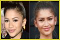 Unveiling The Truth: Zendaya's Plastic Surgery Journey
